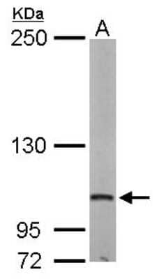 Western Blot: DAP5 Antibody [NBP1-31469] - Sample (50 ug of whole cell lysate) A: Mouse brain 5% SDS PAGE, antibody diluted at 1:500.