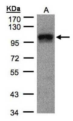 Western Blot: DAP5 Antibody [NBP1-31469] - Sample(30 ug of whole cell lysate) A:A431 7.5% SDS PAGE, antibody diluted at 1:1000.