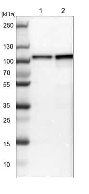 Western Blot: DAP5 Antibody [NBP1-85310] - Lane 1: NIH-3T3 cell lysate (Mouse embryonic fibroblast cells). Lane 2: NBT-II cell lysate (Rat Wistar bladder tumor cells).