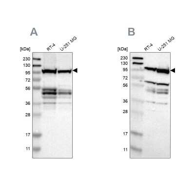 Western Blot: DAP5 Antibody [NBP1-85310] - Analysis using Anti-EIF4G2 antibody NBP1-85310 (A) shows similar pattern to independent antibody NBP1-85311 (B).