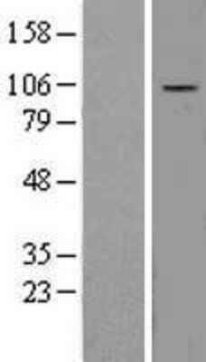 Western Blot: DAP5 Overexpression Lysate (Adult Normal) [NBL1-10210] Left-Empty vector transfected control cell lysate (HEK293 cell lysate); Right -Over-expression Lysate for DAP5.