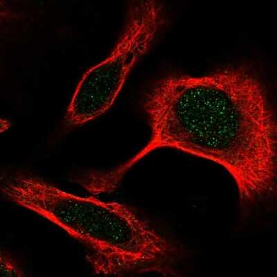 Immunocytochemistry/Immunofluorescence: DAPK3/ZIPK Antibody [NBP2-57540] - Staining of human cell line U-2 OS shows localization to nucleus.