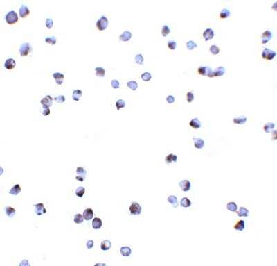 Immunocytochemistry/Immunofluorescence: DAPK3/ZIPK Antibody [NBP1-76962] - Staining of ZIPK in Jurkat cells with ZIPK antibody at 5 ug/ml.