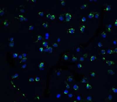 Immunocytochemistry/Immunofluorescence: DAPK3/ZIPK Antibody [NBP1-76962] - Staining of ZIPK in Jurkat cells with ZIPK antibody at 5 ug/ml.