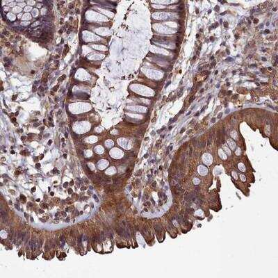 Immunohistochemistry: DAPK3/ZIPK Antibody [NBP1-86832] - Staining of human colon shows moderate cytoplasmic and membranous positivity in glandular cells.