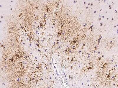 Immunohistochemistry-Paraffin: DAPK3/ZIPK Antibody [NBP2-98766] - Immunochemical staining of human DAPK3/ZIPK in human brain with rabbit polyclonal antibody at 1:1000 dilution, formalin-fixed paraffin embedded sections.