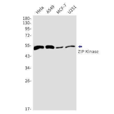 Western Blot: DAPK3/ZIPK Antibody (S02-7F5) [NBP3-15020] - Western blot detection of DAPK3/ZIPK in Hela, A549, MCF-7, U251 cell lysates using DAPK3/ZIPK Rabbit mAb (1:1000 diluted). Predicted band size: 53kDa. Observed band size: 53kDa.