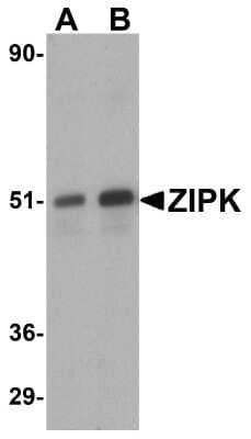 Western Blot: DAPK3/ZIPK Antibody [NBP1-76962] - Analysis of ZIP kinase in (A) HeLa and (B) Jurkat lysates with ZIP kinase antibody at 1 ug/mL.