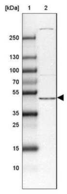 Western Blot: DAPK3/ZIPK Antibody [NBP1-86832] - Lane 1: Marker  [kDa] 250, 130, 100, 70, 55, 35, 25, 15, 10.  Lane 2: Liver