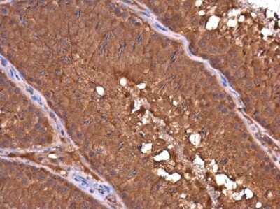 Immunohistochemistry-Paraffin: DAPP1 Antibody (4H9) [NBP3-13531] - DAPP1 antibody [4H9] detects DAPP1 protein at cytoplasm in rat testis by immunohistochemical analysis. Sample: Paraffin-embedded rat testis. DAPP1 antibody [4H9] (NBP3-13531) diluted at 1:100. Antigen Retrieval: Citrate buffer, pH 6.0, 15 min