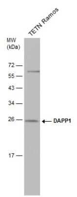 Western Blot: DAPP1 Antibody (4H9) [NBP3-13531] - Whole cell extract (30 ug) was separated by 12% SDS-PAGE, and the membrane was blotted with DAPP1 antibody [4H9] (NBP3-13531) diluted at 1:500.