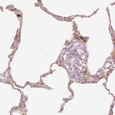 Immunohistochemistry: DAPP1 Antibody [NBP2-33452] - Staining of human lung shows moderate membranous positivity in pneumocytes.