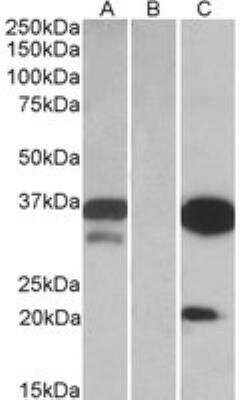 Western Blot: DAPP1 Antibody [NBP2-27542] - HEK293 lysate (10ug protein in RIPA buffer) over expressing Human DAPP1 with DYKDDDDK tag probed with NBP2-27542 (0.1ug/ml) in Lane A and probed with anti- DYKDDDDK Tag (1:3000) in lane C. Mock-transfected HEK293 probed with MBP2-27542 (1mg/ml) in Lane B. Primary incubations were for 1 hour. Detected by chemiluminescence.