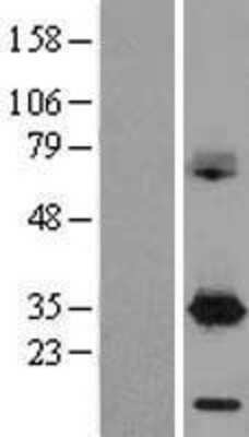 Western Blot: DAPP1 Overexpression Lysate (Adult Normal) [NBL1-09718] Left-Empty vector transfected control cell lysate (HEK293 cell lysate); Right -Over-expression Lysate for DAPP1.