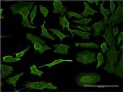 Immunocytochemistry/Immunofluorescence: DARPP-32 Antibody (1A3) [H00084152-M05] - Analysis of monoclonal antibody to PPP1R1B on HeLa cell. Antibody concentration 10 ug/ml