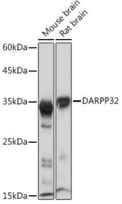 Western Blot: DARPP-32 Antibody (5T9G4) [NBP3-16316] - Western blot analysis of extracts of various cell lines, using DARPP-32 Rabbit mAb (NBP3-16316) at 1:1000 dilution. Secondary antibody: HRP Goat Anti-Rabbit IgG (H+L) at 1:10000 dilution. Lysates/proteins: 25ug per lane. Blocking buffer: 3% nonfat dry milk in TBST. Detection: ECL Basic Kit. Exposure time: 1s.