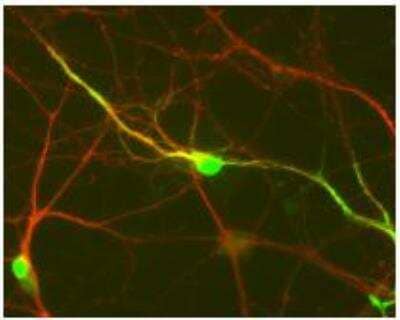 Immunocytochemistry/Immunofluorescence: DARPP-32 Antibody [NB300-304] - Staining of cultured CD1 mouse striatal cells showing specific labeling of DARPP-32 in green and Tuj1 in red.  Cells and photo courtesy of QBMCellScience.