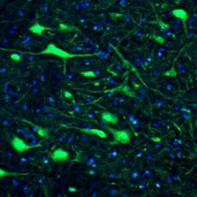 Immunohistochemistry: DARPP-32 Antibody [NBP2-33534] - Staining of mouse motor trigeminal nucleus shows immunoreactivity in neuronal cell bodies.