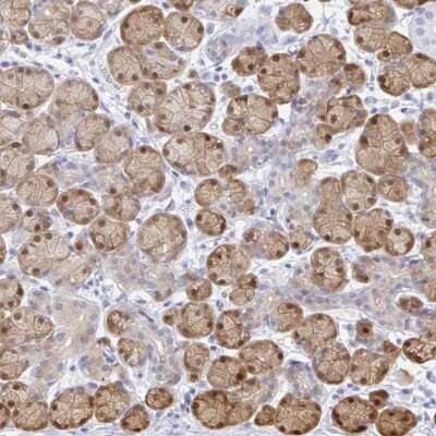 Immunohistochemistry: DARPP-32 Antibody [NBP2-38908] - Staining of human salivary gland shows moderate cytoplasmic and nuclear positivity in glandular cells.