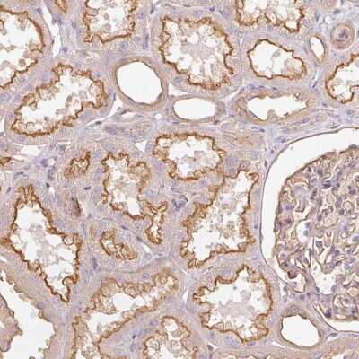 Immunohistochemistry-Paraffin: DARPP-32 Antibody [NBP2-33534] - Immunohistochemical staining of human kidney shows strong membranous positivity in cells in tubules .