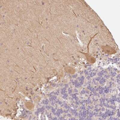 Immunohistochemistry-Paraffin: DARPP-32 Antibody [NBP2-33534] - Staining of human cerebellum shows moderate cytoplasmic positivity in Purkinje cells.