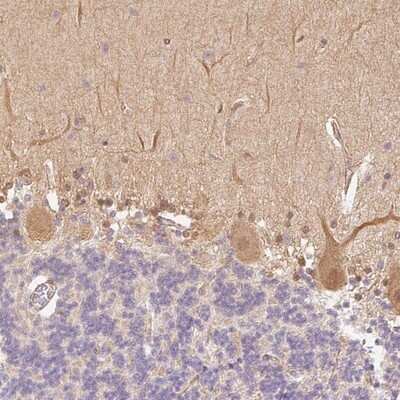 Immunohistochemistry-Paraffin: DARPP-32 Antibody [NBP2-33534] - Staining of human cerebellum shows positivity in Purkinje cells and cells in molecular layer.