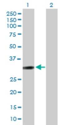 Western Blot: DARPP-32 Antibody [H00084152-B01P] - Analysis of PPP1R1B expression in transfected 293T cell line by PPP1R1B polyclonal antibody.  Lane 1: PPP1R1B transfected lysate(22.44 KDa). Lane 2: Non-transfected lysate.