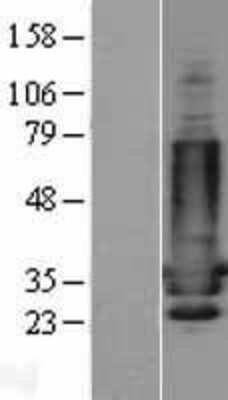 Western Blot DARPP-32 Overexpression Lysate