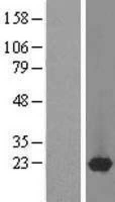 Western Blot DARPP-32 Overexpression Lysate