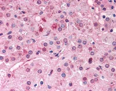Immunohistochemistry-Paraffin: DAX1/NR0B1 Antibody [NLS5716] - Analysis of anti-DAX1 antibody with human adrenal.