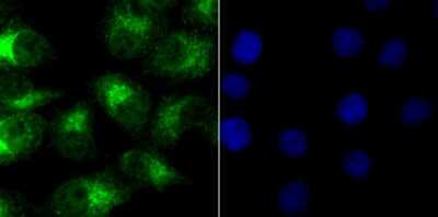 Immunocytochemistry/Immunofluorescence: DAX1/NR0B1 Antibody (JU33-05) [NBP2-75462] - Staining NR0B1 in A549 cells (green). The nuclear counter stain is DAPI (blue). Cells were fixed in paraformaldehyde, permeabilised with 0.25% Triton X100/PBS.