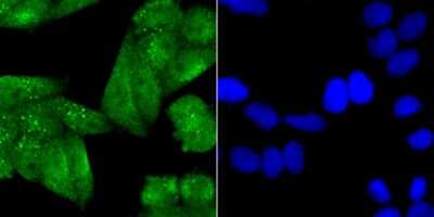 Immunocytochemistry/Immunofluorescence: DAX1/NR0B1 Antibody (JU33-05) [NBP2-75462] - Staining NR0B1 in Hela cells (green). The nuclear counter stain is DAPI (blue). Cells were fixed in paraformaldehyde, permeabilised with 0.25% Triton X100/PBS.