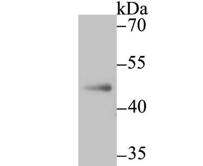 Western Blot: DAX1/NR0B1 Antibody (JU33-05) [NBP2-75462] - Analysis of NR0B1 on A549 cell lysate using anti-NR0B1 antibody at 1/500 dilution.
