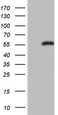 Western Blot: DAX1/NR0B1 Antibody (OTI5F5) - Azide and BSA Free [NBP2-70116] - Analysis of HEK293T cells were transfected with the pCMV6-ENTRY control (Left lane) or pCMV6-ENTRY NR0B1.