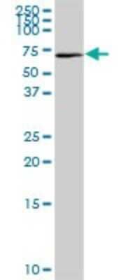 Western Blot: DAX1/NR0B1 Antibody [H00000190-D01P] - Analysis of NR0B1 expression in mouse lung.