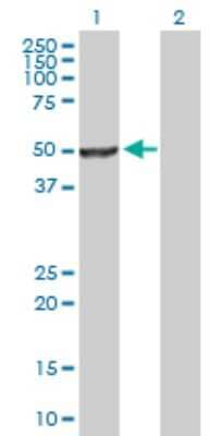 Western Blot: DAX1/NR0B1 Antibody [H00000190-D01P] - Analysis of NR0B1 expression in transfected 293T cell line by NR0B1 polyclonal antibody.Lane 1: NR0B1 transfected lysate(51.70 KDa).Lane 2: Non-transfected lysate.