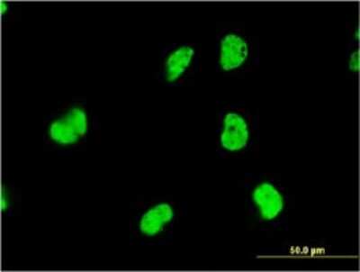 Immunocytochemistry/Immunofluorescence: DAZAP1 Antibody (2F6) [H00026528-M03] - Analysis of monoclonal antibody to DAZAP1 on HeLa cell. Antibody concentration 10 ug/ml