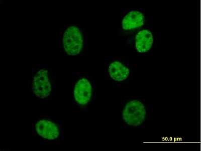 Immunocytochemistry/Immunofluorescence: DAZAP1 Antibody [H00026528-B01P] - Analysis of purified antibody to DAZAP1 on HeLa cell. (antibody concentration 10 ug/ml)