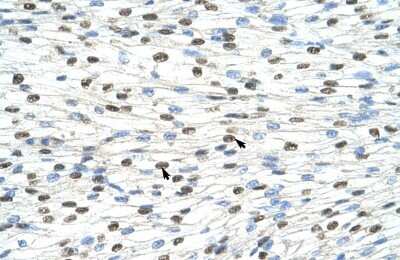 Immunohistochemistry-Paraffin: DAZAP1 Antibody [NBP1-57255] - Human Heart Tissue, antibody concentration 4-8ug/ml. Cells with positive label: Myocardial cells (indicated with arrows) 400X magnification.