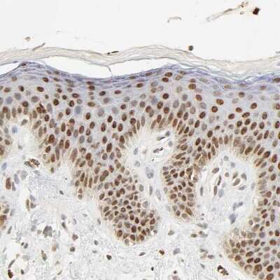 Immunohistochemistry-Paraffin: DAZAP1 Antibody [NBP1-82740] - Staining of human skin shows moderate to strong nuclear positivity in squamous epithelial cells.