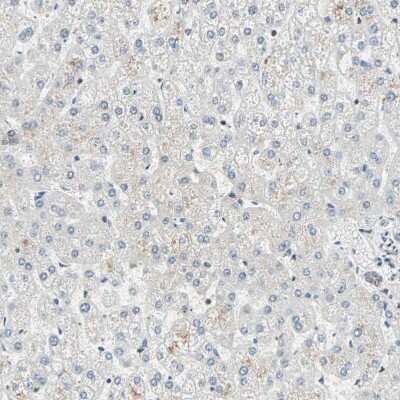 Immunohistochemistry-Paraffin: DAZAP1 Antibody [NBP1-82741] - Staining of human liver shows no weak positivity in hepatocytes as expected.