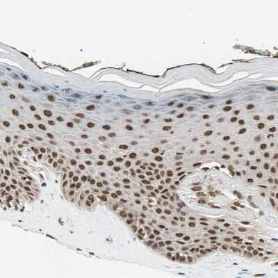 Immunohistochemistry-Paraffin: DAZAP1 Antibody [NBP1-82741] - Staining of human skin shows moderate to strong nuclear positivity in squamous epithelial cells.