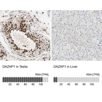 Immunohistochemistry-Paraffin DAZAP1 Antibody - BSA Free