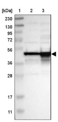 Western Blot: DAZAP1 Antibody [NBP1-82741] - Lane 1: Marker  [kDa] 230, 130, 95, 72, 56, 36, 28, 17, 11.  Lane 2: Human cell line RT-4.  Lane 3: Human cell line U-251MG sp
