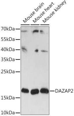 Western Blot: DAZAP2 Antibody [NBP2-92144] - Analysis of extracts of various cell lines, using DAZAP2 Rabbit pAb at 1:3000 dilution. Secondary antibody: HRP Goat Anti-Rabbit IgG (H+L) at 1:10000 dilution.Lysates/proteins: 25ug per lane. Blocking buffer: 3% nonfat dry milk in TBST.Detection: ECL Basic Kit. Exposure time: 30s.