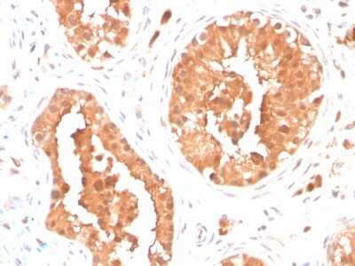 Immunohistochemistry-Paraffin: DAZL Antibody (DAZL/4253) - Azide and BSA Free [NBP3-08742] - Formalin-fixed, paraffin-embedded human testis stained with DAZL Mouse Monoclonal Antibody (DAZL/4253).