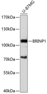 Western Blot: DBC1 Antibody [NBP2-92049] - Analysis of extracts of U-87MG cells, using DBC1 at 1:1000 dilution.Secondary antibody: HRP Goat Anti-Rabbit IgG (H+L) at 1:10000 dilution.Lysates/proteins: 25ug per lane.Blocking buffer: 3% nonfat dry milk in TBST.Detection: ECL Basic Kit .Exposure time: 1s.