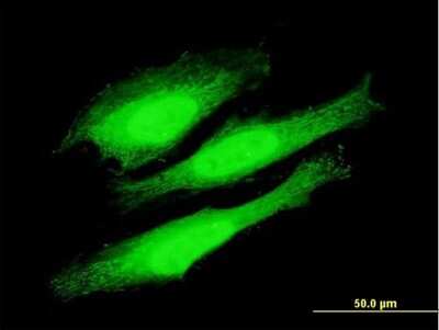 Immunocytochemistry/Immunofluorescence: DBC1/p30 Antibody [H00057805-B01P] - Analysis of purified antibody to KIAA1967 on HeLa cell. (antibody concentration 10 ug/ml)