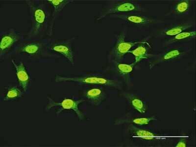Immunocytochemistry/Immunofluorescence: DBC1/p30 Antibody [H00057805-D01P] - Analysis of antibody to KIAA1967 on HeLa cell. Antibody concentration 10 ug/ml.