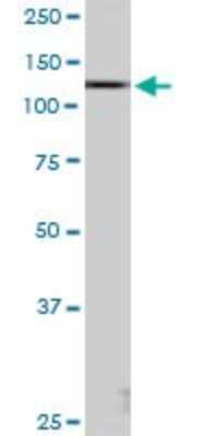 Western Blot: DBC1/p30 Antibody [H00057805-B01P] - Analysis of KIAA1967 expression in Jurkat.